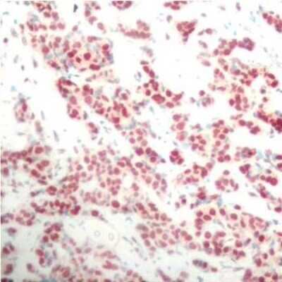 Immunohistochemistry-Paraffin: NFkB2/NFkB p100 [p Ser866] Antibody - Azide and BSA Free [NBP3-16894]